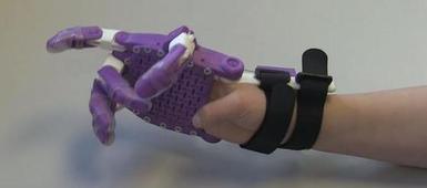 C-NS students seeking candidate for prosthetic hand